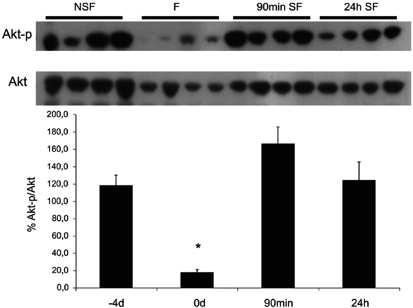 Drawing 2 Insulins Phosphorylation Of the Insulin Like Growth Factor Igf Pathway