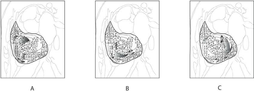 Drawing 7 Bme Motion Estimation Of In Plane Mr Signals Based On Schematic Display