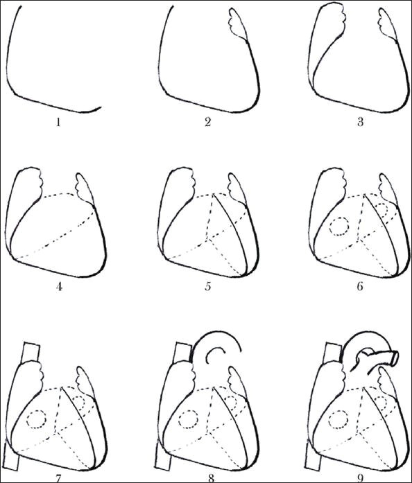 Drawing A Human Heart Step by Step Net Sketch at Paintingvalley Com Explore Collection Of Net Sketch