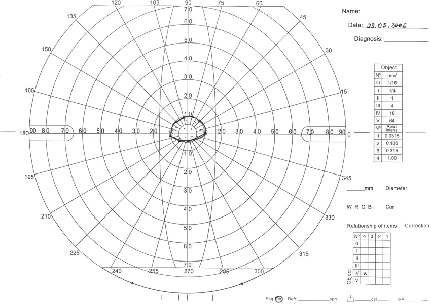 Drawing Eye Diagram Manual Perimetry In Od Abbreviation Od Right Eye Download