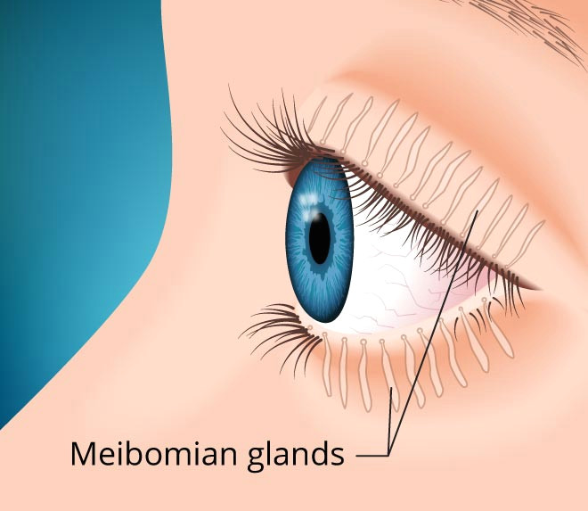 Drawing Eyes On Your Eyelids What You Should Know About Meibomian Gland Dysfunction Mgd