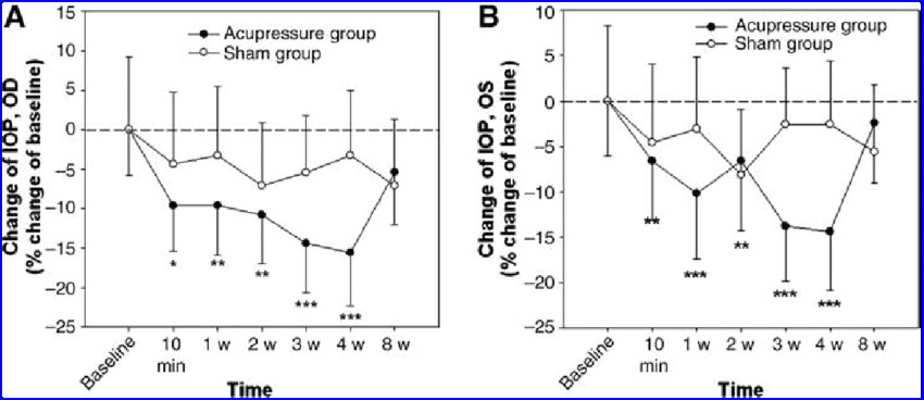 Drawing Left Eye Changes Of Intraocular Pressure before and after Auricular