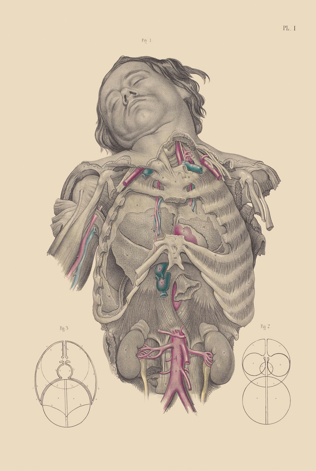 Drawing Of A Dissected Heart Gruesome and Surreal Surgical Illustrations From the 15th 19th