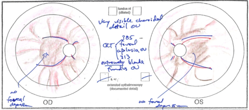 Drawing Of Eye Diagram My Efforts as An Artist Learning to Draw the Retina Matt Weed Md