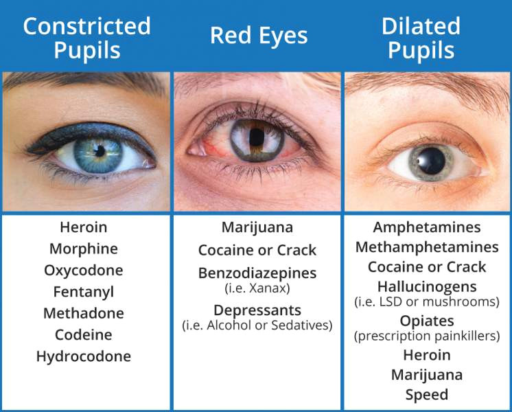 Drawing Of Eyes On Drugs What Drugs Cause Red Eyes and Dilated Pupils sober College