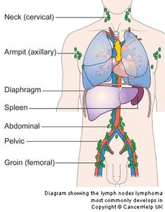 Drawing Of Heart Cancer 188 Best Hodgkin S Lymphoma Images Inspirational Qoutes Quotes