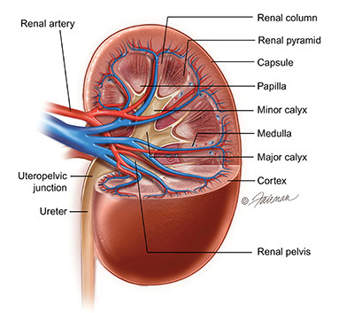 Drawing Of Heart Cancer What is A Renal Mass and What is A Localized Renal Tumor Urology