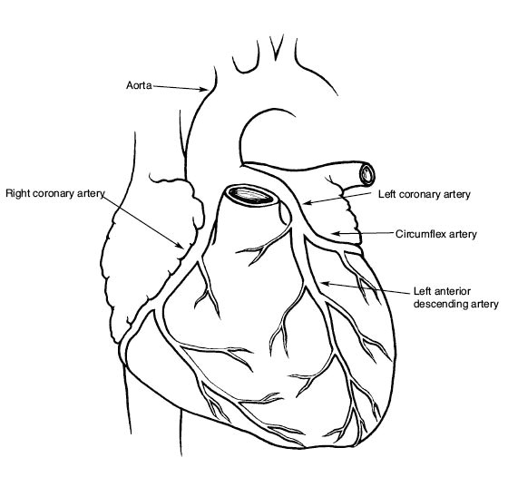 Drawing Of Open Heart Surgery Cardiac Catheterization Heart Cath Angiography Stents attack