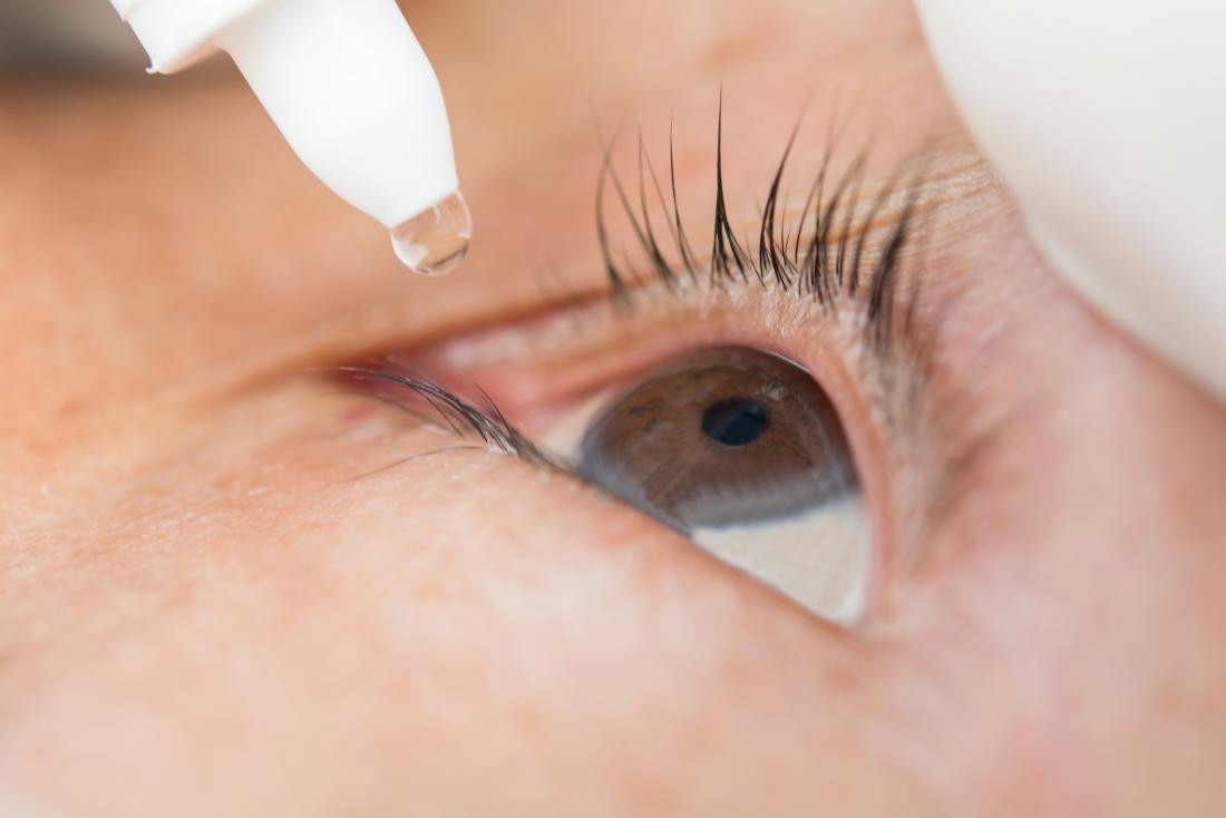Drawing Out Eye Infection Blepharitis Treatment Symptoms Pictures and Causes