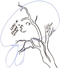 Easy Drawing Using Shapes 24 Best Drawing Trees Pencil Images Drawing Trees Paintings