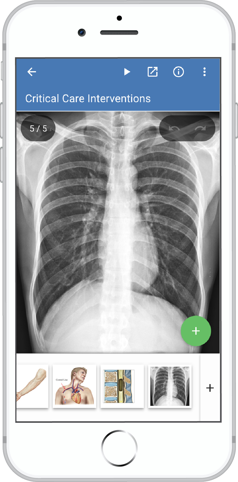 Easy X Ray Drawing Drawmd Patient Education for Healthcare Providers