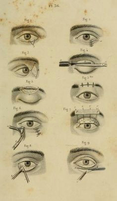 Medical Drawing Of An Eye 236 Best Vintage Medical Illustrations Images Human Anatomy