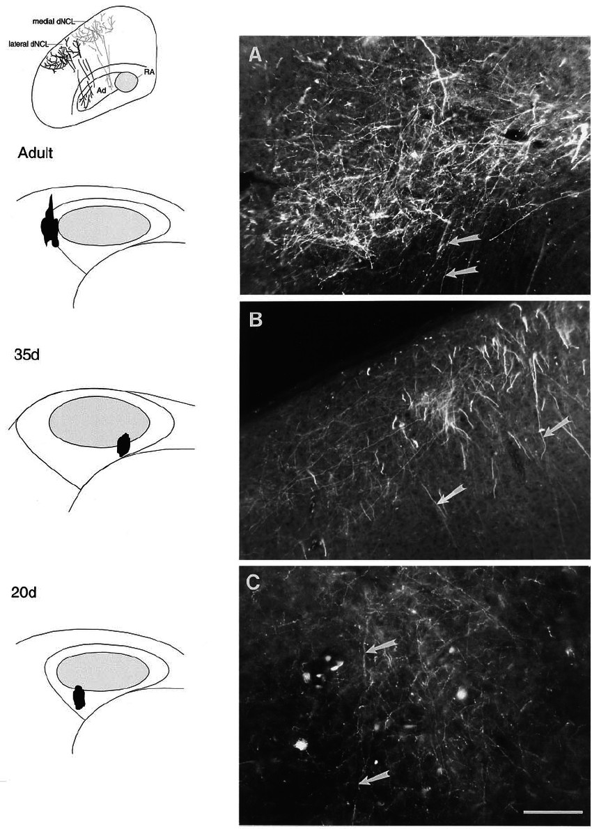 Unduh Drawing Cartoons 2 Photomicrographs Showing Anterograde Label Over Dncl after