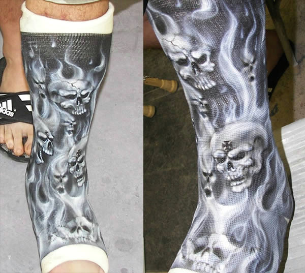 Leg Cast Drawing Ideas 15 Awesome Cast Designs Oddee