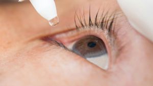 Drawing Out Eye Infection Blepharitis Treatment Symptoms Pictures and Causes